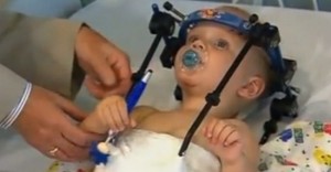 decapitated-toddlers-head-reattached