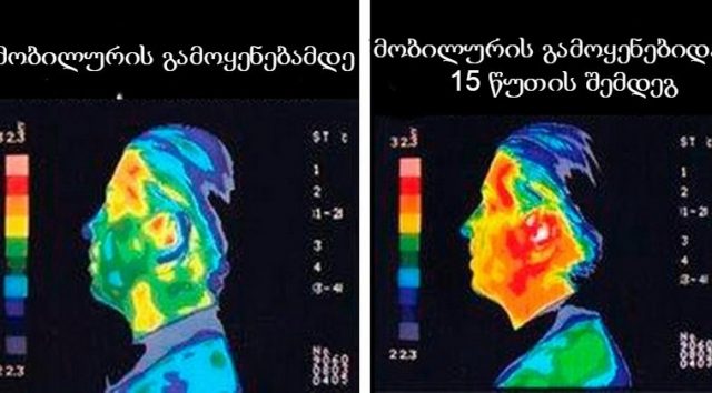 radiation1-750x375-760x420