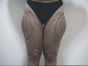 14627994_1404533589576836_1738596492_n