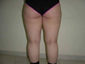 14741010_1404533722910156_2040297067_n