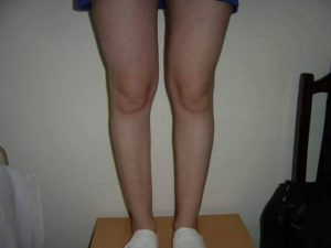 14741702_1404533749576820_692605547_n