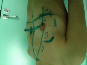 14794083_1404533619576833_351757880_n