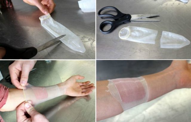 10740760-bandage-1485959862-650-8c0a0fedb0-1486577948 (1)